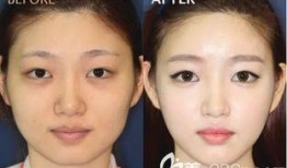 新疆整形爆料案件最新进展